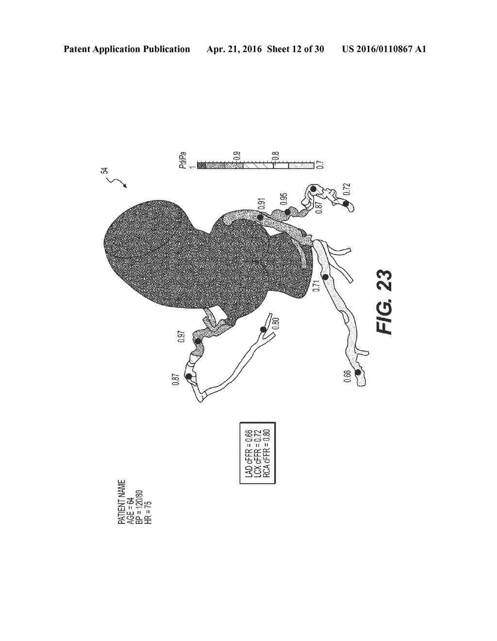 METHOD AND SYSTEM FOR IMAGE PROCESSING TO DETERMINE PATIENT-SPECIFIC BLOOD     FLOW CHARACTERISTICS - diagram, schematic, and image 13