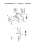 METHOD AND SYSTEM FOR IMAGE PROCESSING TO DETERMINE PATIENT-SPECIFIC BLOOD     FLOW CHARACTERISTICS diagram and image