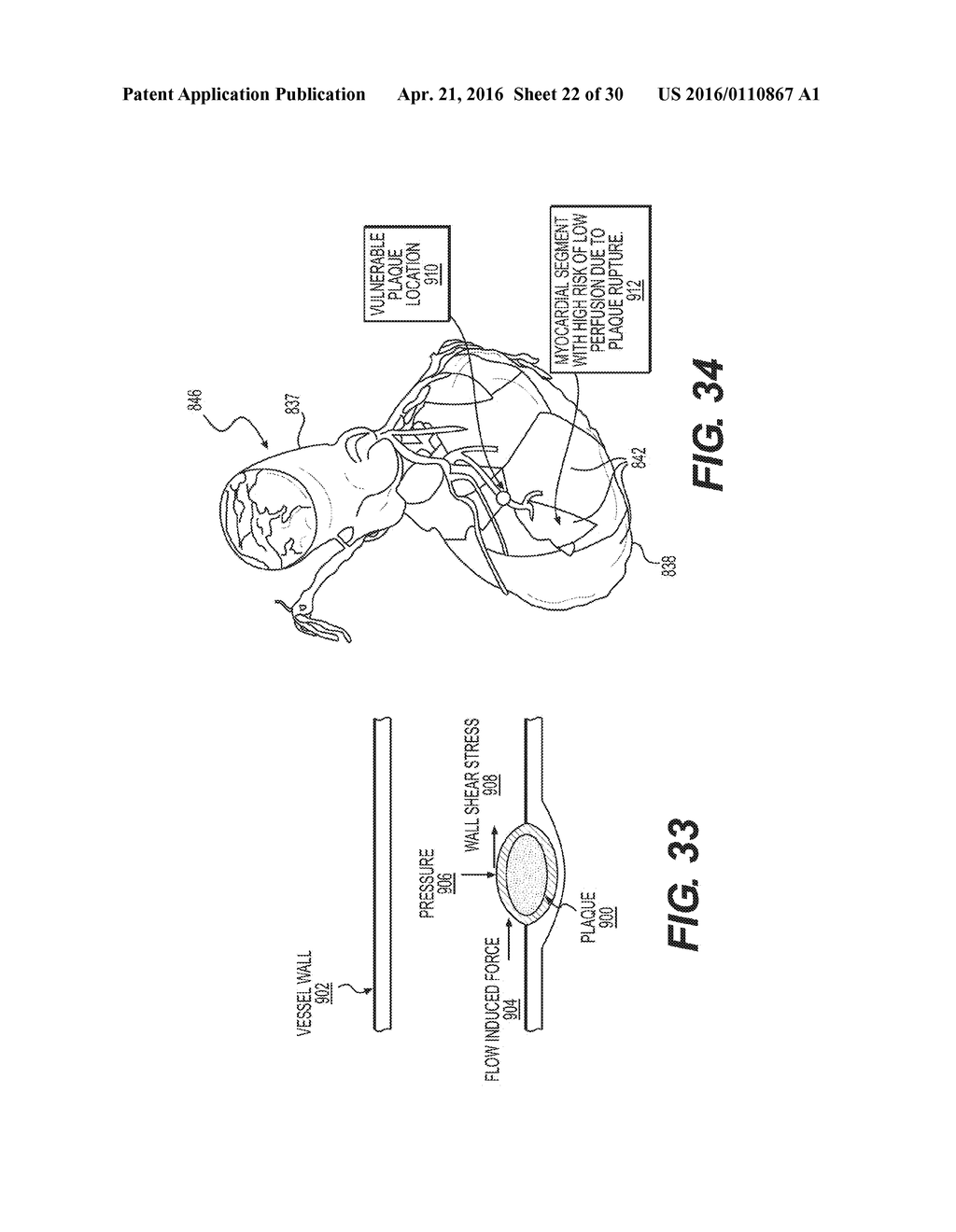 METHOD AND SYSTEM FOR IMAGE PROCESSING TO DETERMINE PATIENT-SPECIFIC BLOOD     FLOW CHARACTERISTICS - diagram, schematic, and image 23