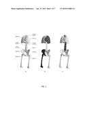 CORTICAL BONE SEGMENTATION FROM MR DIXON DATA diagram and image