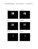 IMAGING A TARGET FLUOROPHORE IN A BIOLOGICAL MATERIAL IN THE PRESENCE OF     AUTOFLUORESCENCE diagram and image