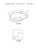 Expectation Maximization to Determine Position of Ambient Glints diagram and image