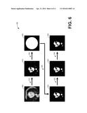 METHODS AND SYSTEMS FOR NORMALIZING CONTRAST ACROSS MULTIPLE ACQUISITIONS diagram and image