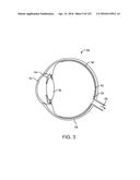 DELIVERING VIEWING ZONES ASSOCIATED WITH PORTIONS OF AN IMAGE FOR     AUGMENTED OR VIRTUAL REALITY diagram and image