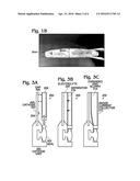 Metal-Air Battery with Expandable Anode diagram and image