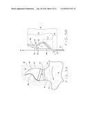 Cutting Disk and System For Vertically Mowing Turf diagram and image