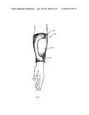 EXOSKELETON SYSTEM diagram and image