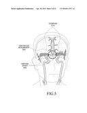 APPARATUS AND METHOD FOR ENHANCING ACCURACY OF A CONTACTLESS BODY     TEMPERATURE MEASUREMENT diagram and image