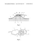 DEVICE FOR APPLYING ELECTRODE ASSEMBLIES diagram and image