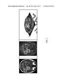 METHODS AND SYSTEMS FOR PROCESSING MRI IMAGES TO DETECT CANCER diagram and image