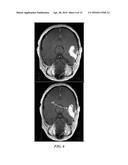 METHODS AND SYSTEMS FOR PROCESSING MRI IMAGES TO DETECT CANCER diagram and image