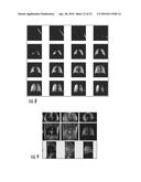 SYSTEMS, METHODS, COMPOSITIONS AND DEVICES FOR IN VIVO MAGNETIC RESONANCE     IMAGING OF LUNGS USING PERFLUORINATED GAS MIXTURES diagram and image