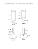 SENSORS FOR CONTINUOUS ANALYTE MONITORING, AND RELATED METHODS diagram and image