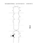 SYSTEMS AND METHODS FOR DIAGNOSIS OF DEPRESSION AND OTHER MEDICAL     CONDITIONS diagram and image