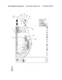 APPARATUS FOR PERFORMING A BIOPSY ON A PATIENT S BREAST AND     COMPUTER-IMPLEMENTED METHOD FOR DEFINING A ROUTE FOR A BIOPSY NEEDLE     THROUGH A PATIENT S BREAST diagram and image