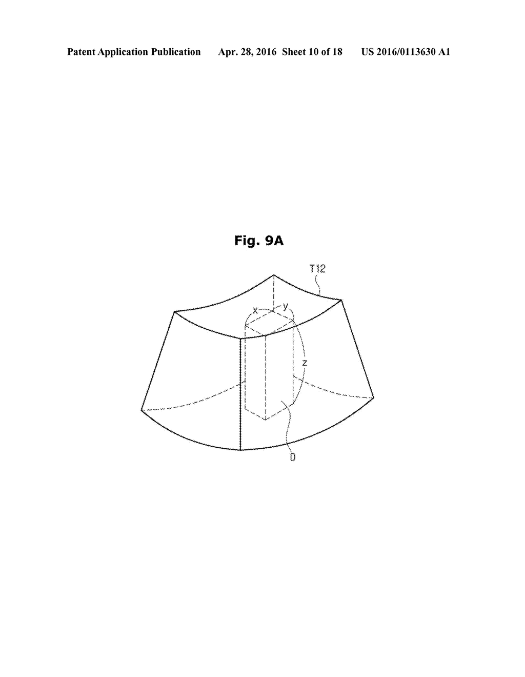 ULTRASOUND IMAGING APPARATUS AND METHOD OF CONTROLLING THE SAME - diagram, schematic, and image 11