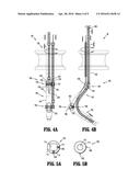 Triangulation Methods with Hollow Segments diagram and image