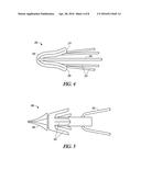 IMPLANT WITH SUTURE ANCHOR FIXATION CAPABILITY diagram and image