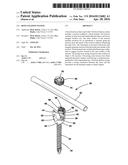 Bone fixation system diagram and image