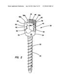 Bone fixation system diagram and image