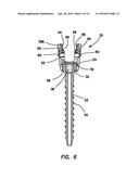 Bone fixation system diagram and image