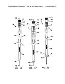 Bone fixation system diagram and image