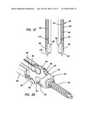 Bone fixation system diagram and image