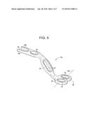 Laminoplasty Plates and Methods of Expanding the Spinal Canal diagram and image