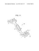 Laminoplasty Plates and Methods of Expanding the Spinal Canal diagram and image