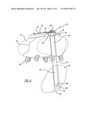 METHOD OF IMPLANTING A BONE FIXATION ASSEMBLY diagram and image