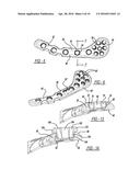 METHOD OF IMPLANTING A BONE FIXATION ASSEMBLY diagram and image