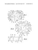 METHOD OF IMPLANTING A BONE FIXATION ASSEMBLY diagram and image