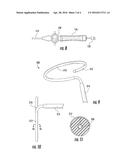 ABLATION CATHETER AND METHOD OF FORMING A CIRCULAR LESION diagram and image