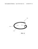 ABLATION CATHETER AND METHOD OF FORMING A CIRCULAR LESION diagram and image