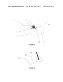 SYSTEM FOR THE TREATMENT OF A PLANNED VOLUME OF A BODY PART diagram and image