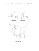 SYSTEM FOR THE TREATMENT OF A PLANNED VOLUME OF A BODY PART diagram and image