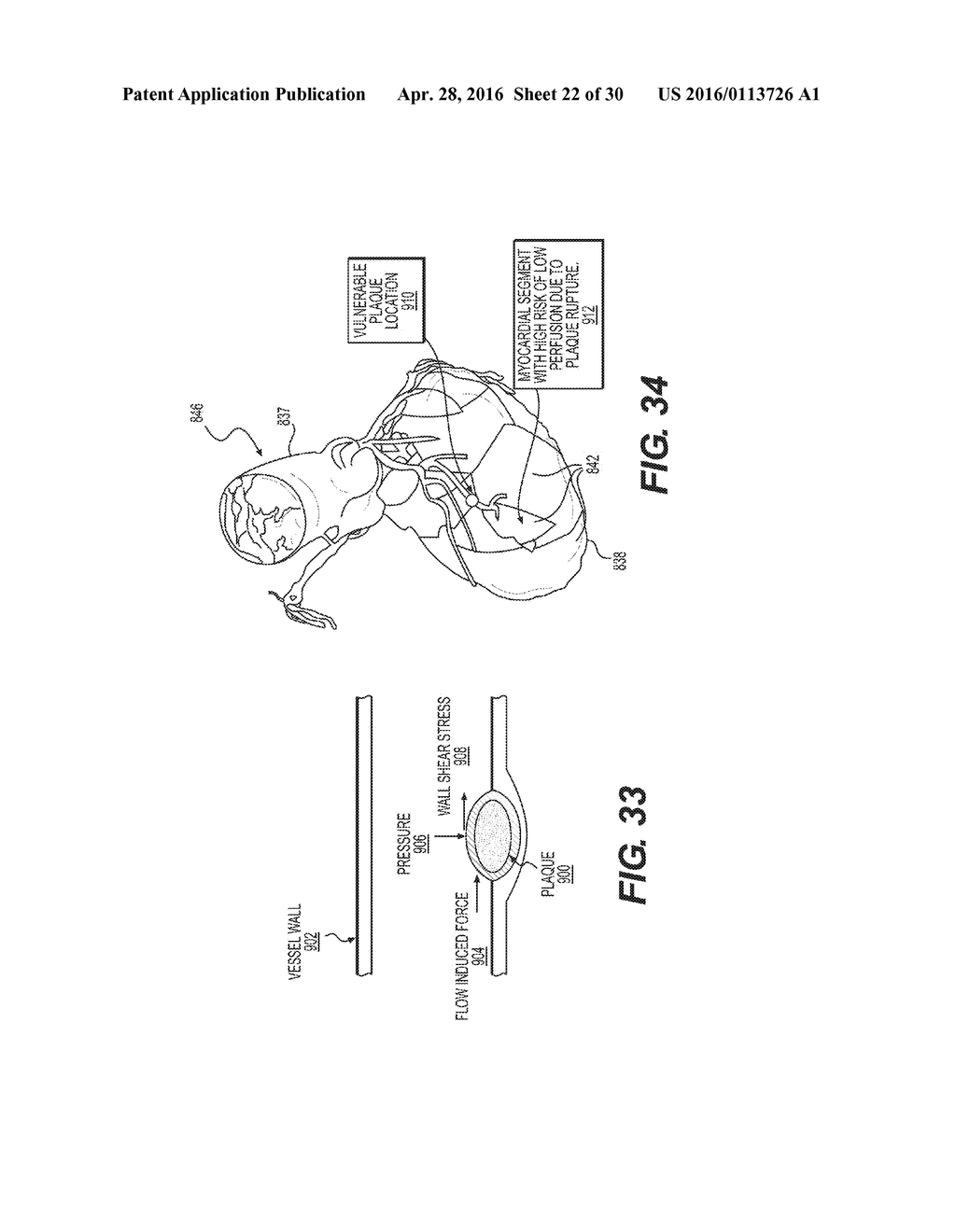 METHOD AND SYSTEM FOR IMAGE PROCESSING TO DETERMINE PATIENT-SPECIFIC BLOOD     FLOW CHARACTERISTICS - diagram, schematic, and image 23