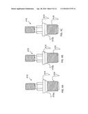 DENTAL IMPLANT DEVICE, SYSTEM AND METHOD OF USE diagram and image