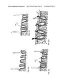 DENTAL IMPLANT DEVICE, SYSTEM AND METHOD OF USE diagram and image