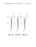 Retainerless Orthodontic Dental Implant System diagram and image