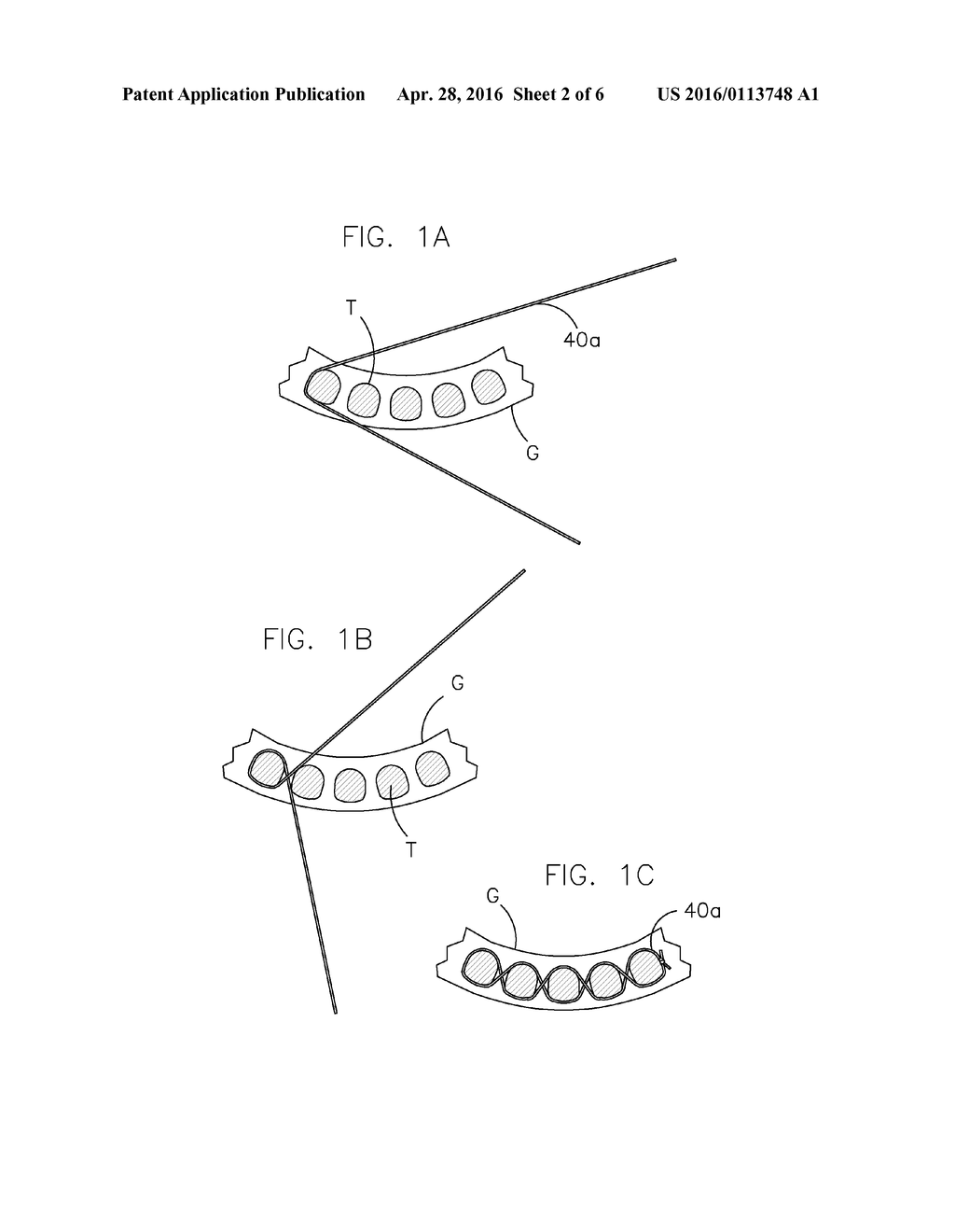 DENTAL PROSTHESIS FOR CATTLE - diagram, schematic, and image 03