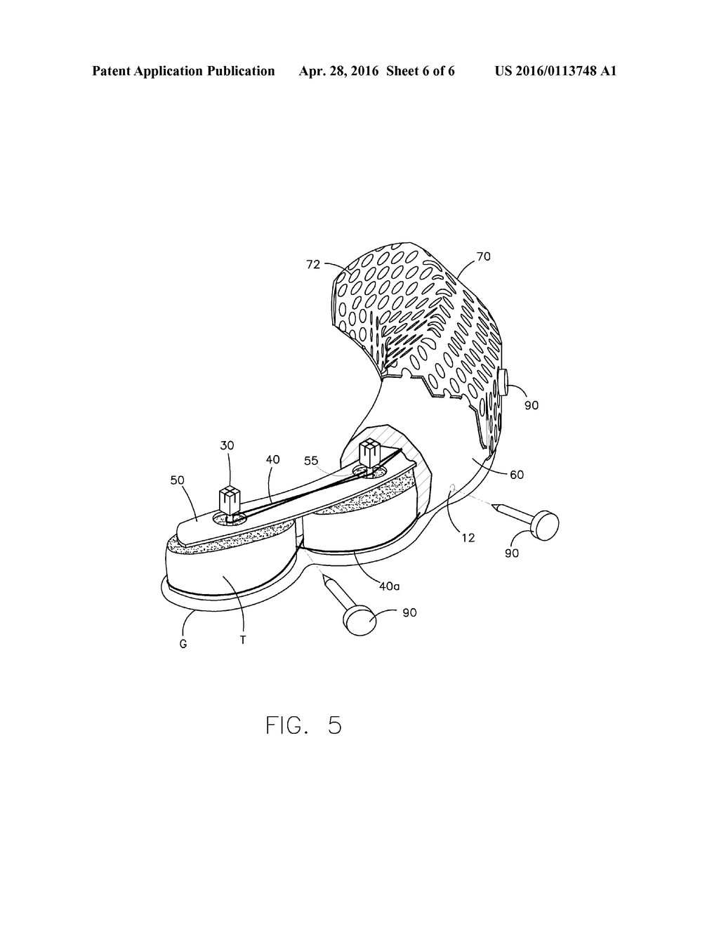 DENTAL PROSTHESIS FOR CATTLE - diagram, schematic, and image 07