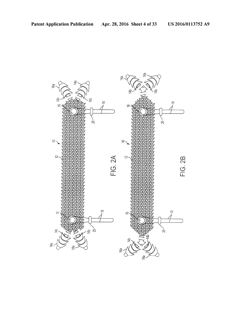 ATRAUMATIC MEDICAL DEVICE ANCHORING AND DELIVERY SYSTEM WITH ENHANCED     ANCHORING - diagram, schematic, and image 05