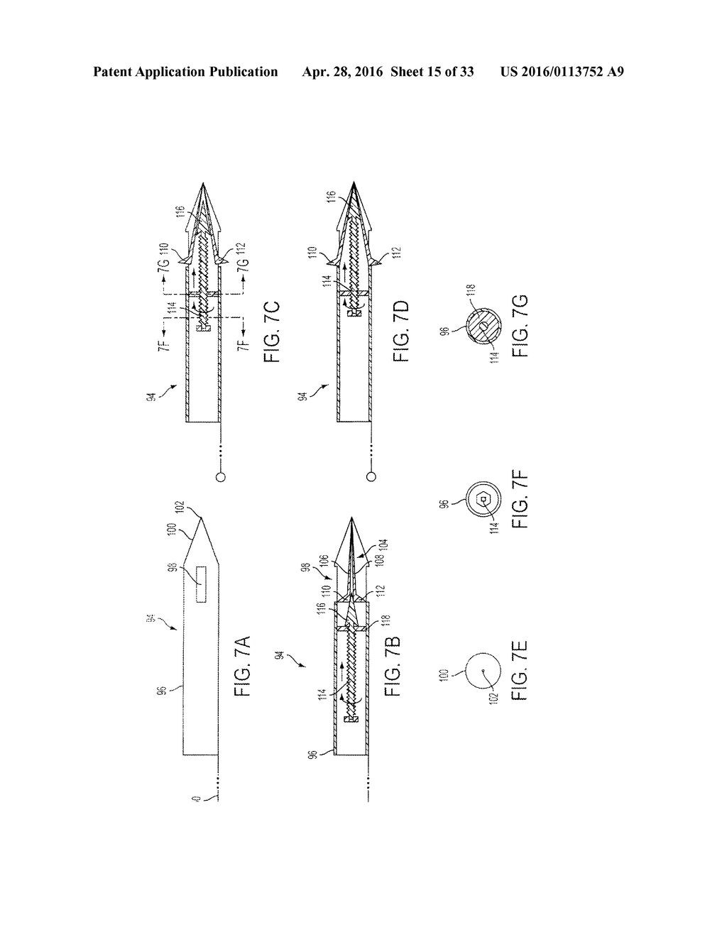 ATRAUMATIC MEDICAL DEVICE ANCHORING AND DELIVERY SYSTEM WITH ENHANCED     ANCHORING - diagram, schematic, and image 16