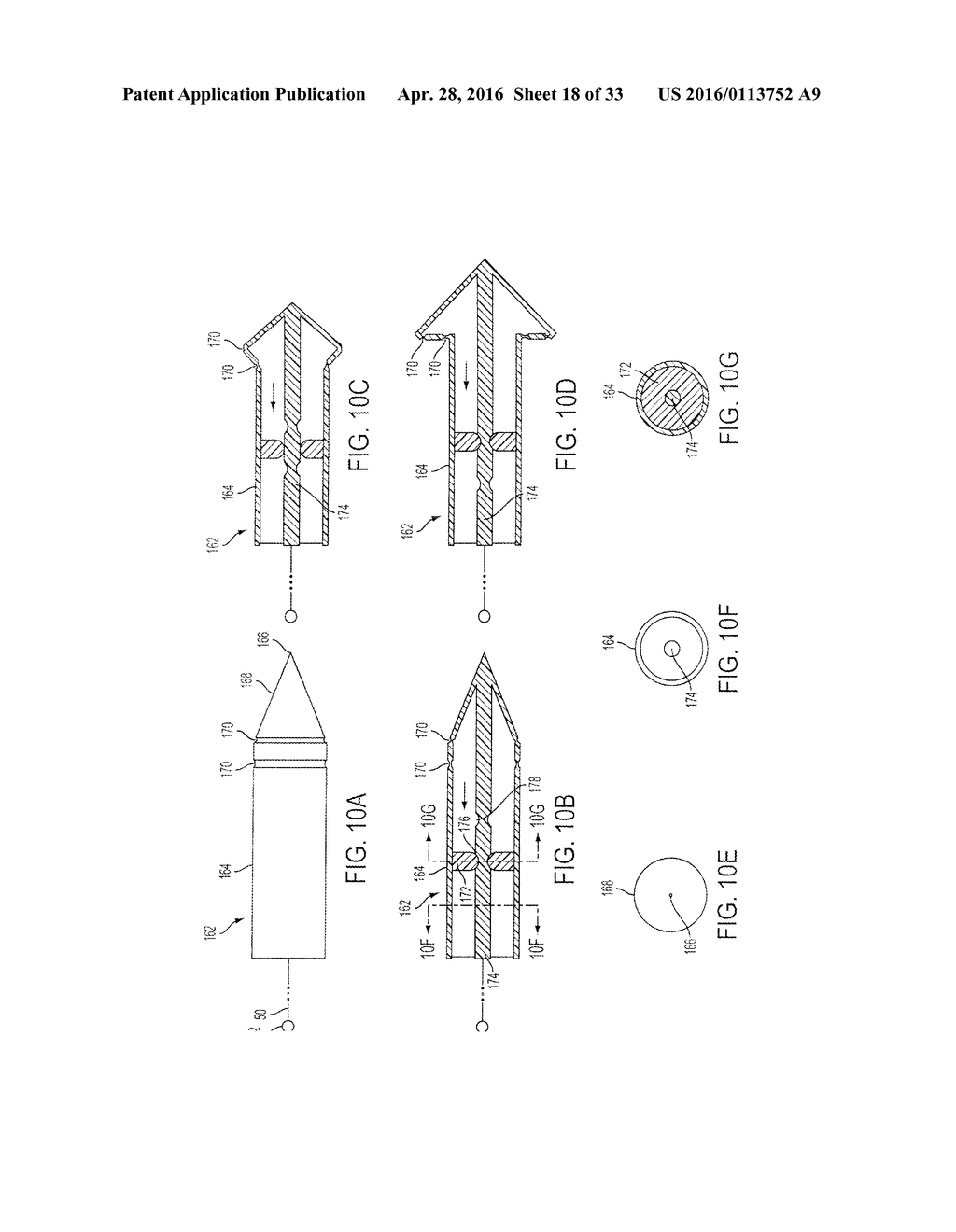 ATRAUMATIC MEDICAL DEVICE ANCHORING AND DELIVERY SYSTEM WITH ENHANCED     ANCHORING - diagram, schematic, and image 19