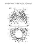 SYSTEMS AND METHODS FOR HEART VALVE THERAPY diagram and image