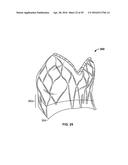 SYSTEMS AND METHODS FOR HEART VALVE THERAPY diagram and image