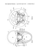 SYSTEMS AND METHODS FOR HEART VALVE THERAPY diagram and image