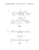 Total Disc Replacement System and Related Methods diagram and image