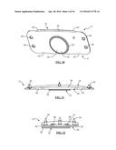 Total Disc Replacement System and Related Methods diagram and image